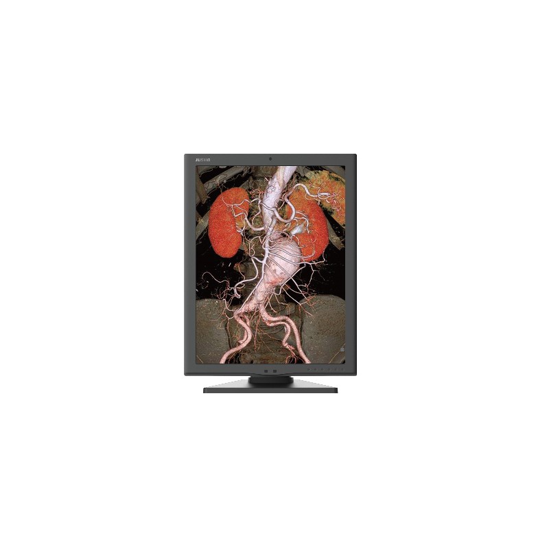 Monitor medyczny JUSHA C270G 21,3"