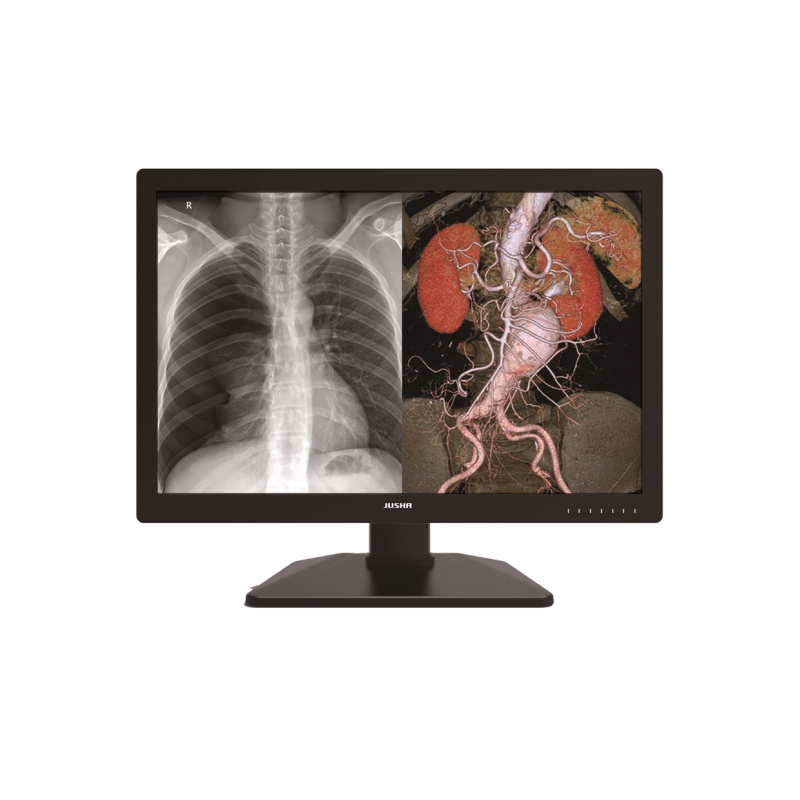Monitor medyczny JUSHA C660G 30"