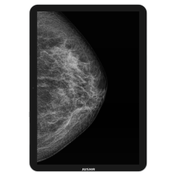 Przenośny monitor medyczny JUSHA CP620 13,5"