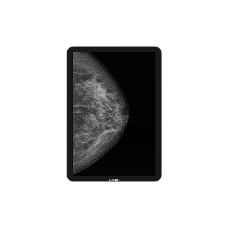 Przenośny monitor medyczny JUSHA CP620 13,5"