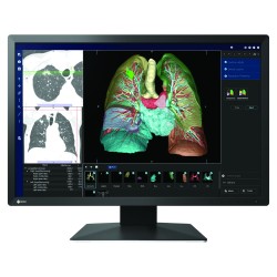 Monitor medyczny EIZO...