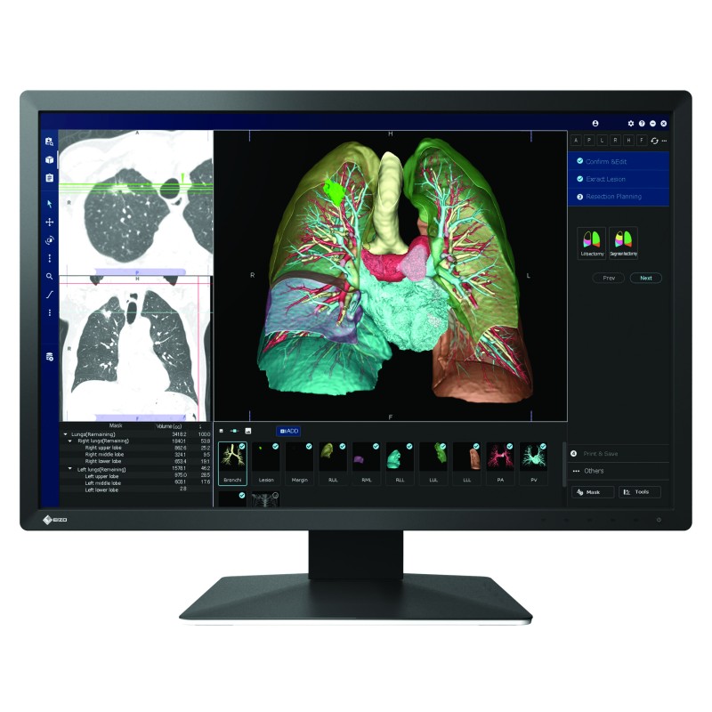 Monitor medyczny EIZO RadiForce MX243W 24,1"