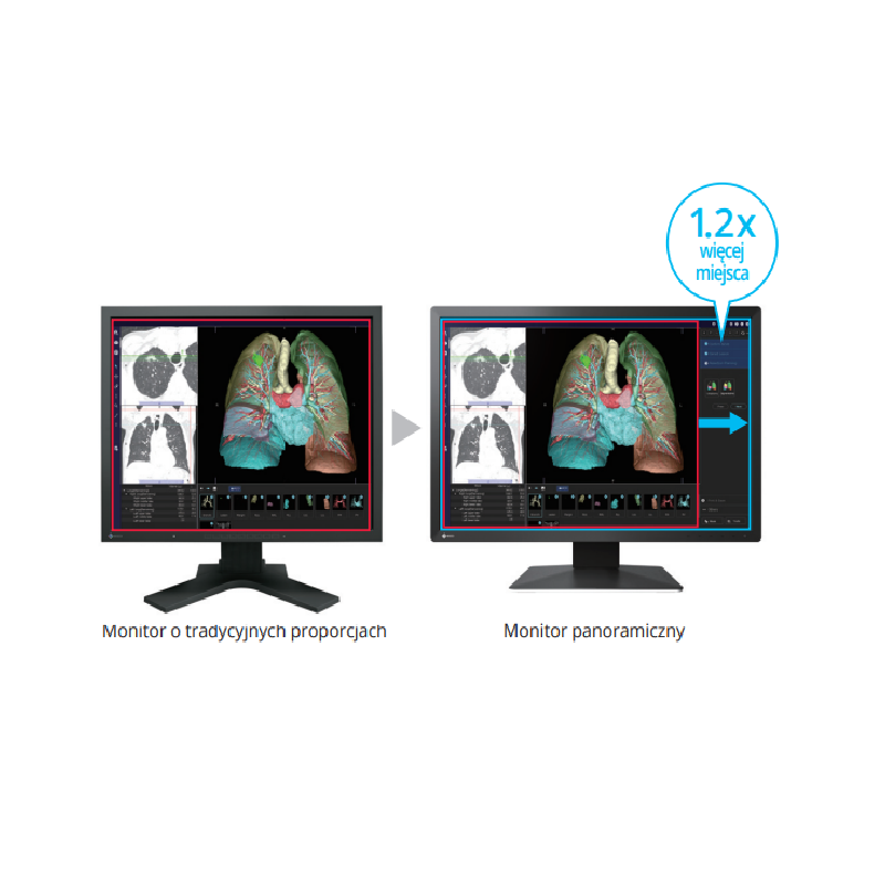 Monitor medyczny EIZO RadiForce MX243W 24,1"