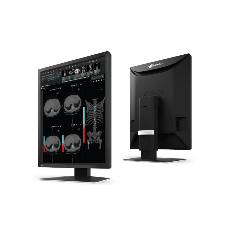 Monitor medyczny EIZO RadiForce MX217 21.3"