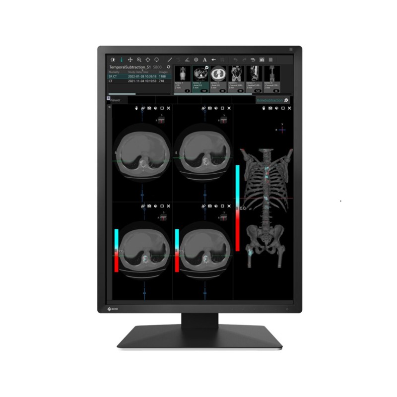 Monitor medyczny EIZO RadiForce MX217 21.3"