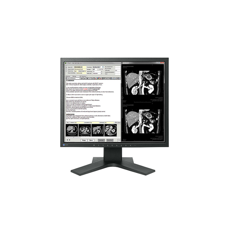 Monitor medyczny EIZO RadiForce MX194 19"