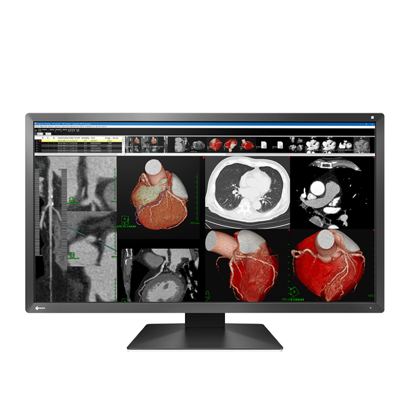 Monitor medyczny EIZO RadiForce MX317W 30,5"