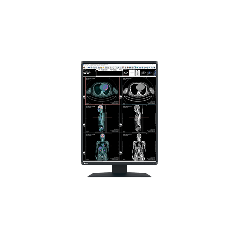 Monitor medyczny EIZO RadiForce RX370 21,3"