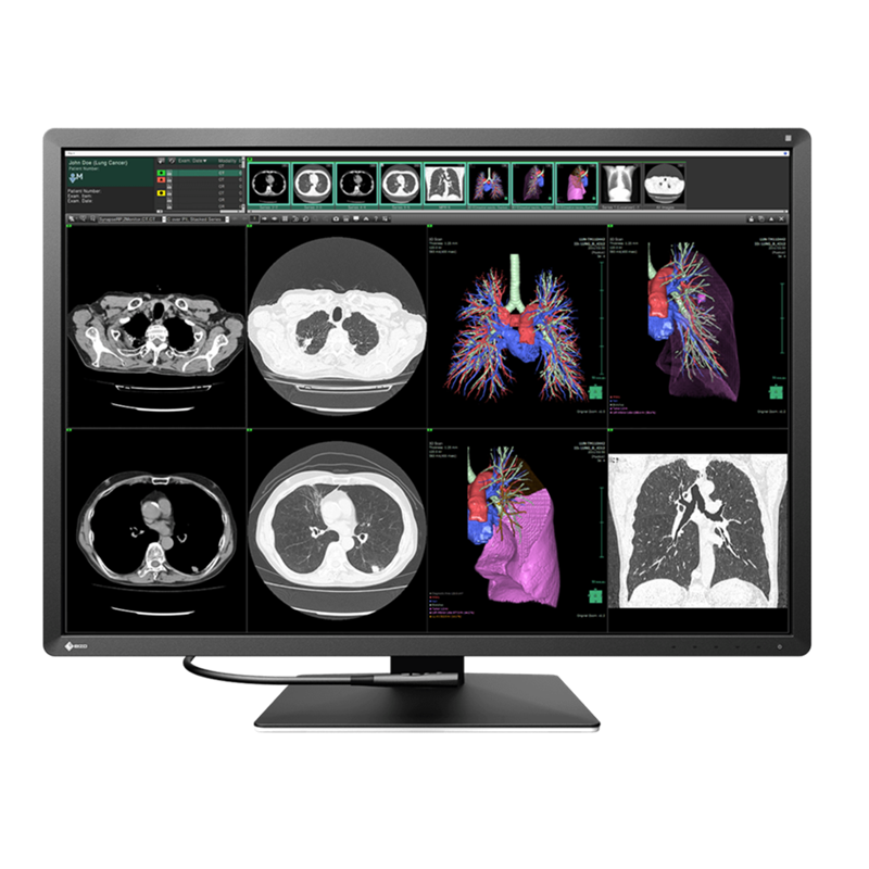 Monitor medyczny EIZO RadiForce RX1270 30,9"